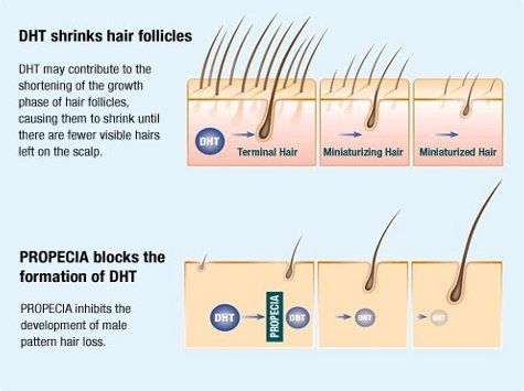 How medical hair loss treatments work